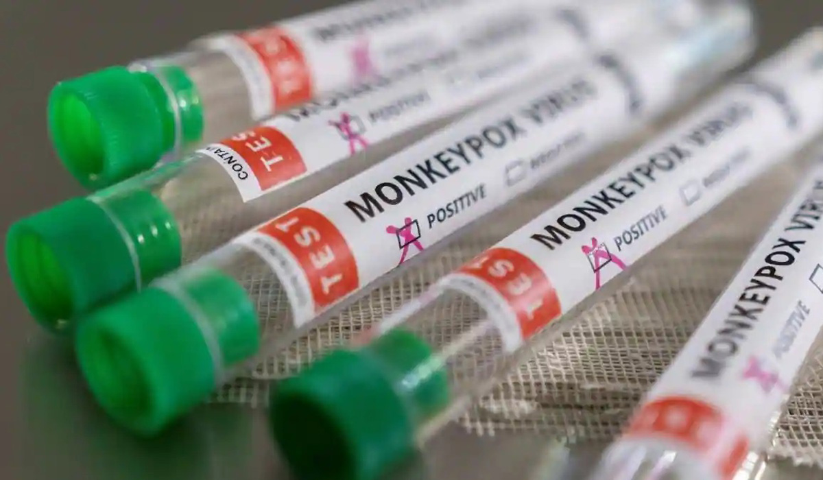 Monkeypox Virus